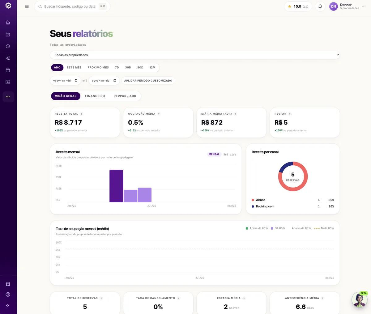Relatório financeiro do SmartOwners com receita, despesas e resultado por imóvel